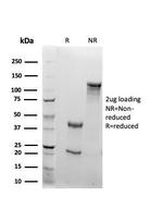 RBP4/Retinol Binding Protein 4 Antibody in SDS-PAGE (SDS-PAGE)
