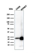 RBP4/Retinol Binding Protein 4 Antibody in Western Blot (WB)