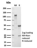 RBP4/Retinol Binding Protein 4 Antibody in Immunoelectrophoresis (IE)
