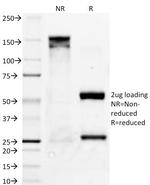 Bcl-X (Apoptosis Marker) Antibody in SDS-PAGE (SDS-PAGE)