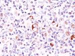 Bcl-X (Apoptosis Marker) Antibody in Immunohistochemistry (Paraffin) (IHC (P))