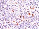 Bcl-X (Apoptosis Marker) Antibody in Immunohistochemistry (Paraffin) (IHC (P))