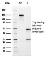 Bcl-X (Apoptosis Marker) Antibody in SDS-PAGE (SDS-PAGE)