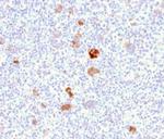 Bcl-X (Apoptosis Marker) Antibody in Immunohistochemistry (Paraffin) (IHC (P))