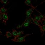 TRIM27 Antibody in Immunocytochemistry (ICC/IF)