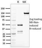 BCL2-like 2 Antibody in SDS-PAGE (SDS-PAGE)