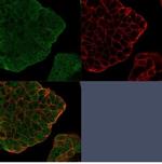 BCL2-like 2 (BCL2L2)/BCL-W Antibody in Immunocytochemistry (ICC/IF)