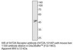 5HT2A Receptor Antibody in Western Blot (WB)