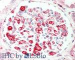 Apolipoprotein C-II Antibody in Immunohistochemistry (Paraffin) (IHC (P))