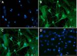 Doublecortin Antibody in Immunocytochemistry (ICC/IF)