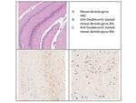 Doublecortin Antibody in Immunohistochemistry (IHC)