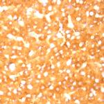 SPHK1 Antibody in Immunohistochemistry (Paraffin) (IHC (P))