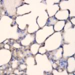 BTC Antibody in Immunohistochemistry (Paraffin) (IHC (P))