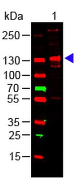 Collagen Type III Antibody in Western Blot (WB)