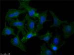 beta Amyloid Antibody in Immunocytochemistry (ICC/IF)