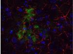 beta Amyloid Antibody in Immunohistochemistry (Frozen) (IHC (F))