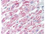 beta Amyloid Antibody in Immunohistochemistry (Paraffin) (IHC (P))