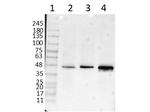 beta Amyloid Antibody in Western Blot (WB)