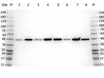 beta Amyloid Antibody in Western Blot (WB)