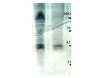 Phosphothreonine Antibody in Western Blot (WB)