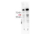 Phospho-NFkB (Ser276) Antibody in Western Blot (WB)