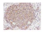 Phospho-AKT (Ser473) Antibody in Immunohistochemistry (Paraffin) (IHC (P))