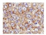 Phospho-AKT (Ser473) Antibody in Immunohistochemistry (Paraffin) (IHC (P))