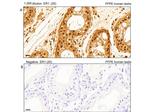 Phospho-AKT (Thr308) Antibody in Immunohistochemistry (IHC)