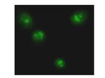 NFkB p65 Antibody in Immunocytochemistry (ICC/IF)