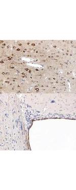 PPAR alpha Antibody in Immunohistochemistry (Paraffin) (IHC (P))