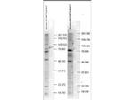 Phospho-SH3BP2 (Ser427) Antibody in Western Blot (WB)