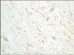 SFRP1 Antibody in Immunohistochemistry (IHC)