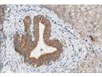 Fbp5A Antibody in Immunohistochemistry (Paraffin) (IHC (P))