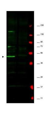 Fbp5A Antibody in Western Blot (WB)