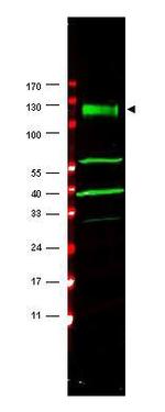 FANCA Antibody in Western Blot (WB)