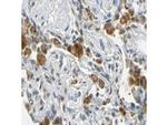 FANCG Antibody in Immunohistochemistry (Paraffin) (IHC (P))