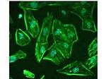 ROBO-1 Antibody in Immunocytochemistry (ICC/IF)