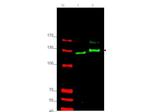 GLI2 Antibody in Western Blot (WB)