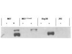 Phospho-SMAD3 (Ser423, Ser425) Antibody in Western Blot (WB)