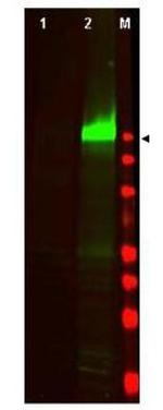 Phospho-EGFR (Tyr1197) Antibody in Western Blot (WB)
