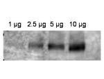 ABCB1 Antibody in Western Blot (WB)