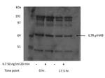 Phospho-IL-7 Receptor alpha Chain (Tyr449) Antibody in Western Blot (WB)