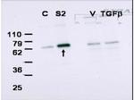 SMAD2 Antibody in Western Blot (WB)