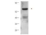 Protein Kinase C beta Antibody in Western Blot (WB)