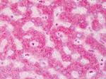 ABCB5 Antibody in Immunohistochemistry (Paraffin) (IHC (P))