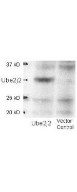 UBE2J2 Antibody in Western Blot (WB)