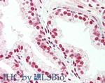 PRDM1 BLIMP1 Antibody in Immunohistochemistry (Paraffin) (IHC (P))