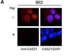 CASZ1 Antibody in Immunocytochemistry (ICC/IF)