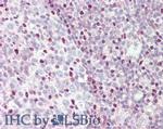 CTCF Antibody in Immunohistochemistry (Paraffin) (IHC (P))