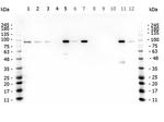 beta Catenin Antibody in Western Blot (WB)